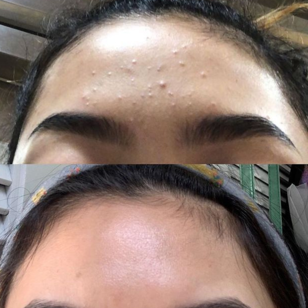 Salicylic & Mandelic Acid Cleanser - Image 5