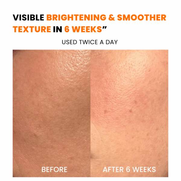 Before After 1 Serum
