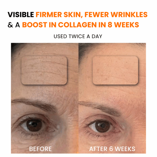 Before After 2 Serum