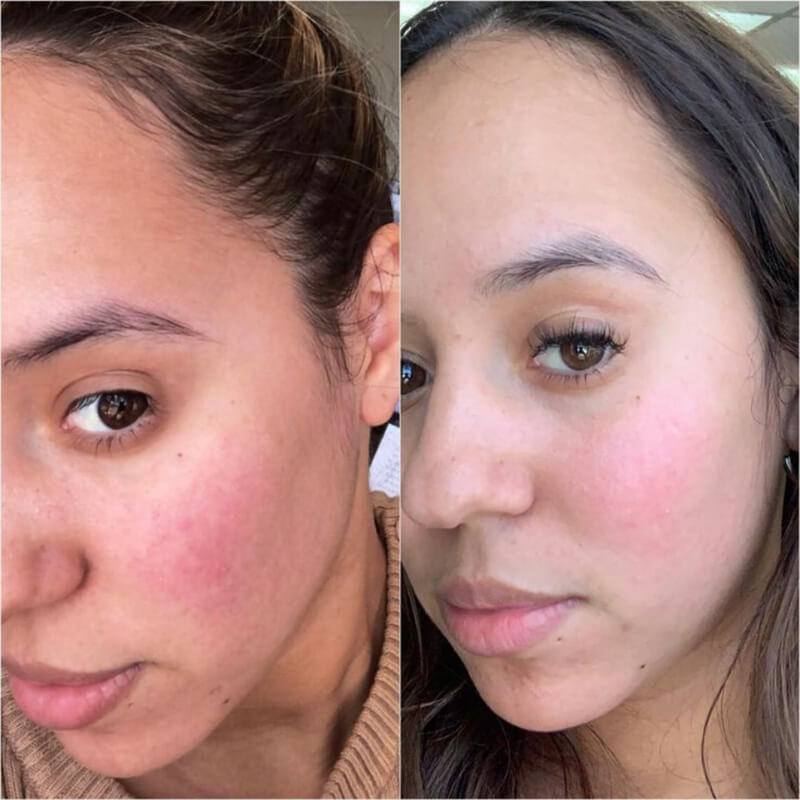Niacéa-10+-Brightening-Moisturizer-result-before-after-one