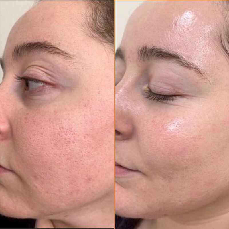 Niacéa-10+-Brightening-Moisturizer-result-before-after-three