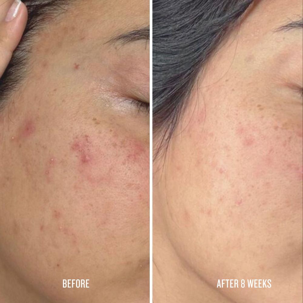 before after toner 1