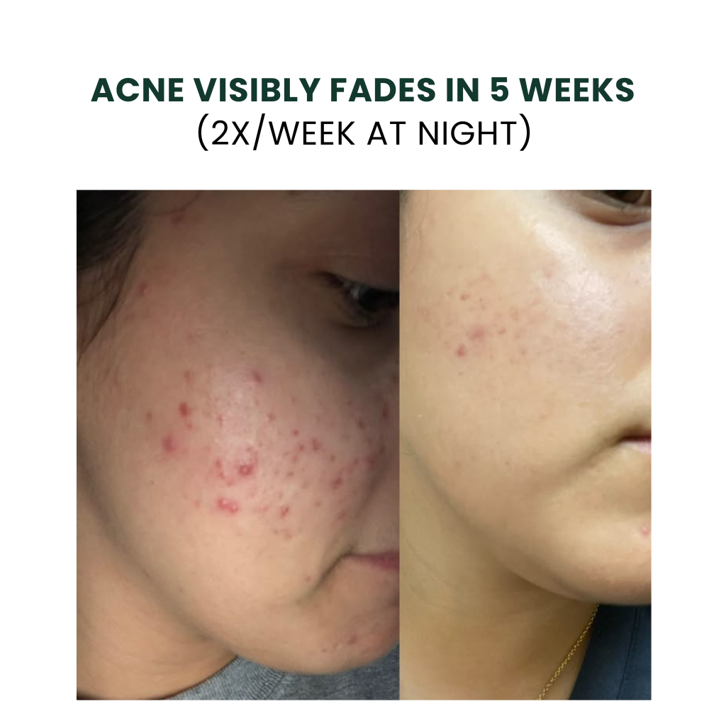 before after toner 2