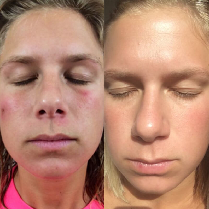 before-after-serum-one