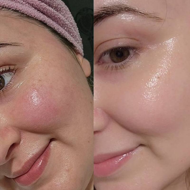 before-after-serum-three-1