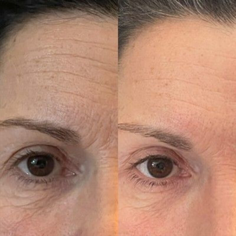 before-after-serum-three