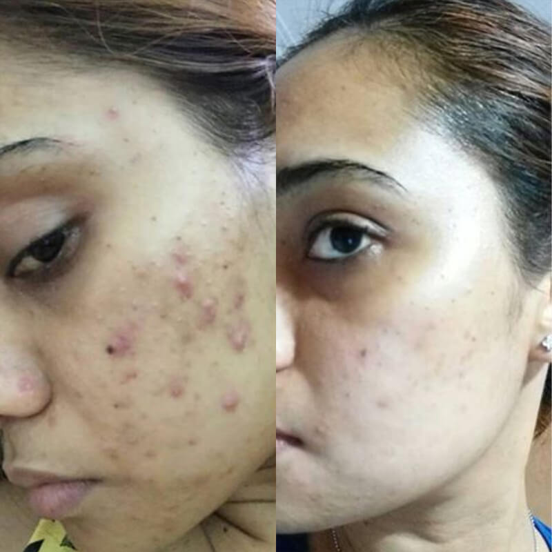 before-after-toner-1
